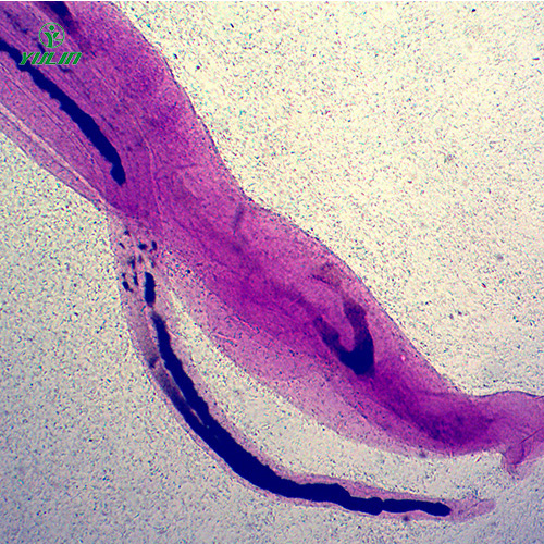甘肃日本血吸虫雌雄合抱装片
