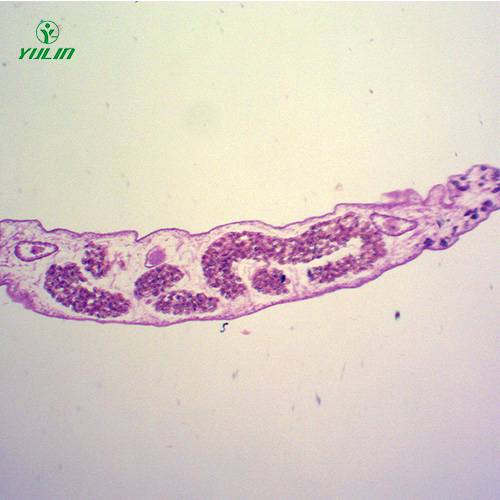 甘肃医学蠕虫吸虫生物切片