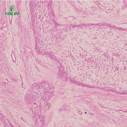 甘肃人口腔病理标本片