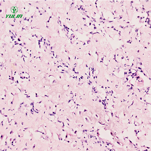 甘肃人肌肉骨骼系统疾病标本片