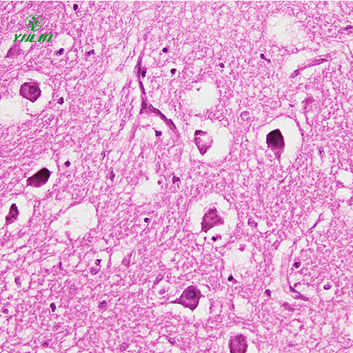 甘肃人神经系统疾病标本片