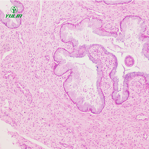 甘肃人泌尿生殖系统疾病标本片