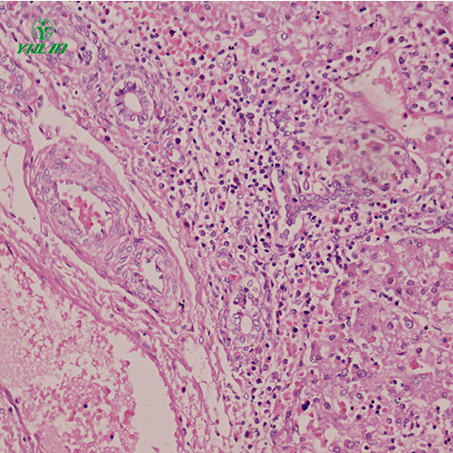 甘肃人消化系统疾病标本片