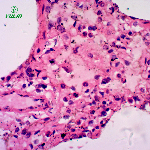甘肃人呼吸系统疾病标本片