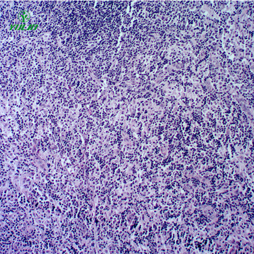 甘肃人体免疫性疾病切片