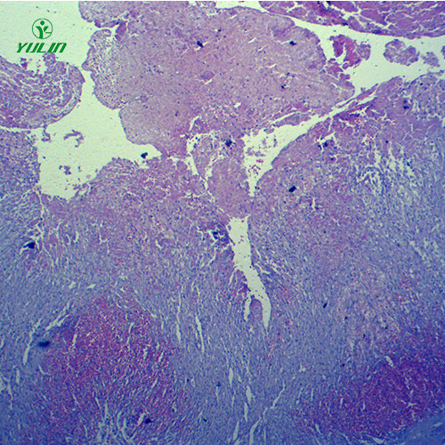 甘肃人体局部血液循环障碍病理玻片