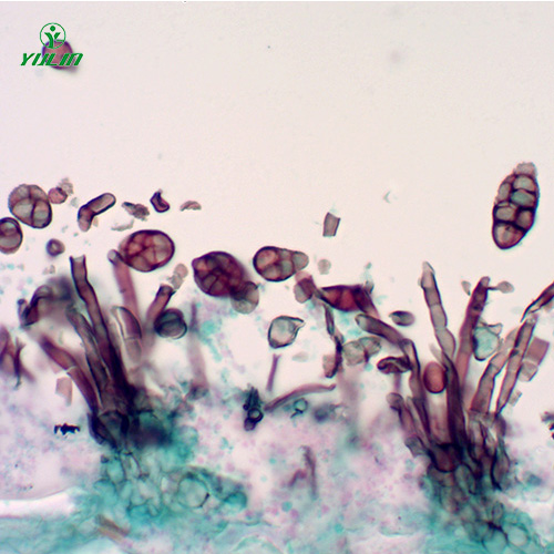 甘肃茄科植物病害玻片