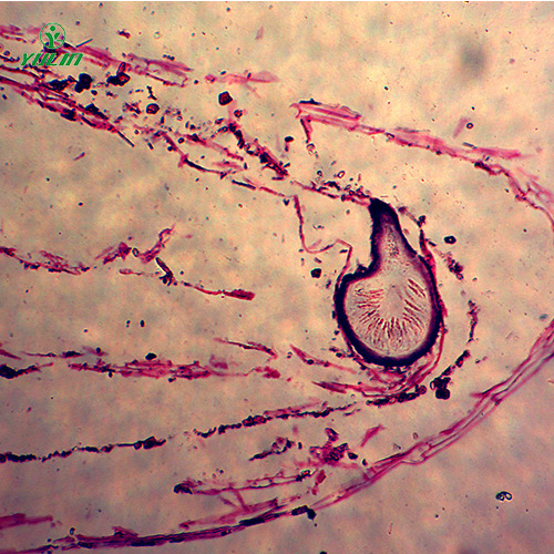 甘肃子囊菌植物病理玻片