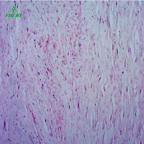 甘肃人体心血管及呼吸系统疾病玻璃玻片