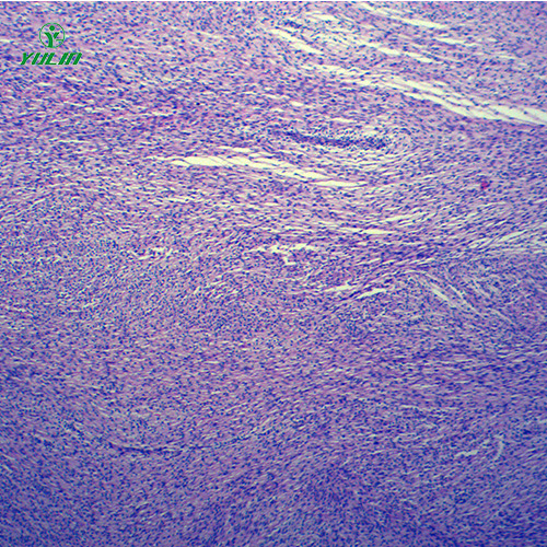 甘肃人体肿瘤病理玻片
